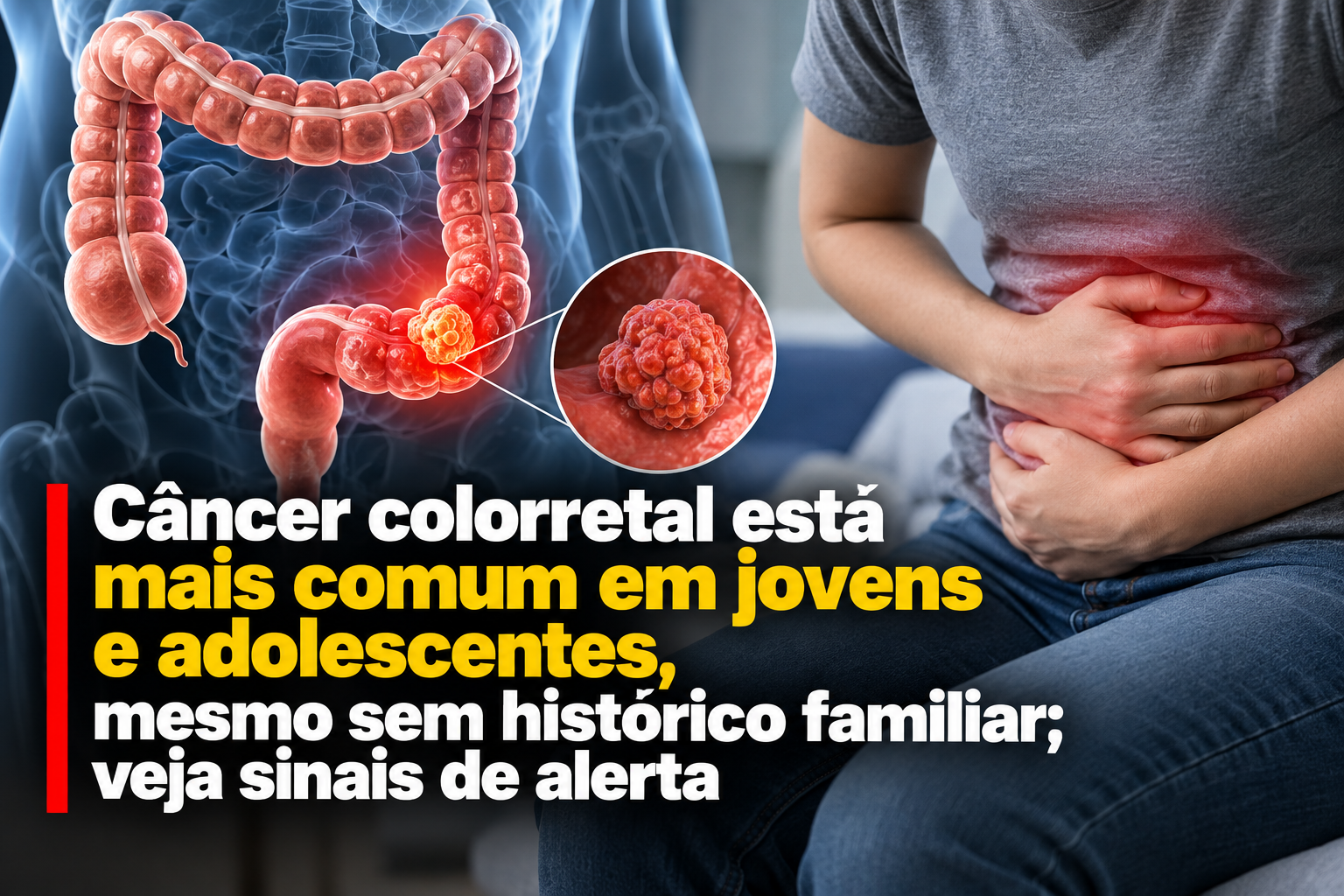 Câncer colorretal cresce entre jovens e acende alerta para sintomas que não devem ser ignorados